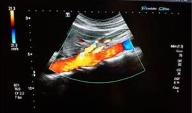 Upper Abdomen