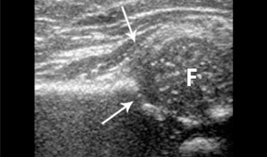 Upper Abdomen