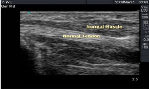 Upper Abdomen