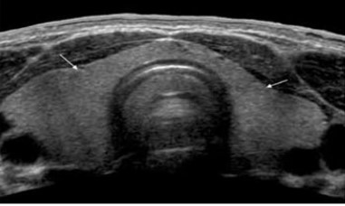 Whole Abdomen