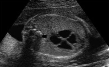 Upper Abdomen