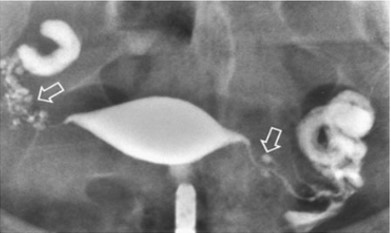 Upper Abdomen
