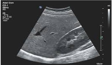 Whole Abdomen